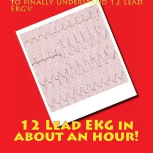 Warranty Included 12 Lead EKG in about an Hour!