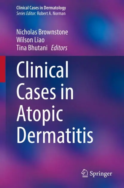 Best Seller Clinical Cases in Atopic Dermatitis