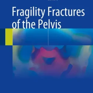 Sale Fragility Fractures of the Pelvis